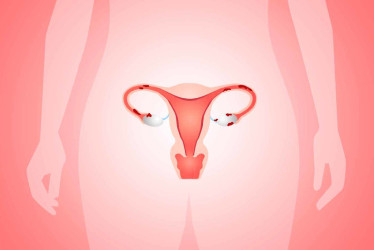 Cáncer de cuello uterino