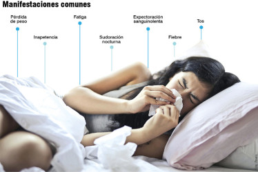 Tubersulosis